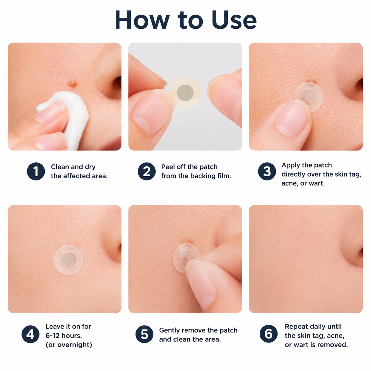 Folivanago™ 2-in-1 Microneedle & Hydrocolloid Patch🍀| Removes Raised Moles, Acne, Flat Warts & Skin Tags | Helps Improve Wrinkles, Scars & Blemishes | Invisible Patches for Face & Body