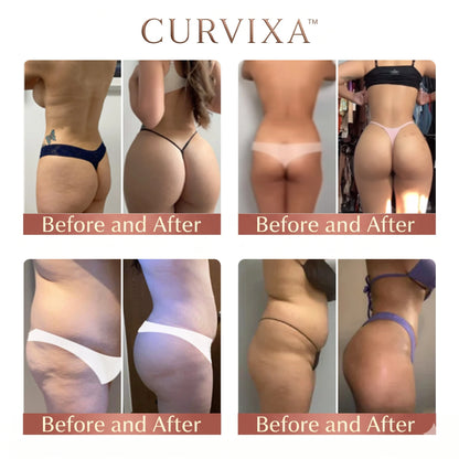 Curvixa™ CurveSculpt Micro-Patch ✦ Sculpt • Firm • Smooth Lower Body Curves ✦ Micro-Needle Infusion System