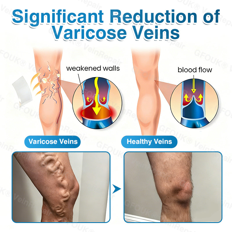 🏆🏃VeinRepair Microneedle Patch Roll⚡Instant Relief, Long-Term Results