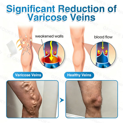 🏆🏃VeinRepair Microneedle Patch Roll⚡Instant Relief, Long-Term Results