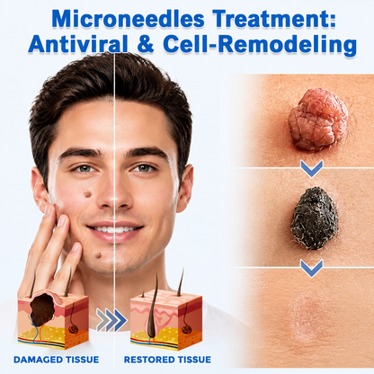 Folivanago™ 2-in-1 Microneedle & Hydrocolloid Patch🍀| Removes Raised Moles, Acne, Flat Warts & Skin Tags | Helps Improve Wrinkles, Scars & Blemishes | Invisible Patches for Face & Body
