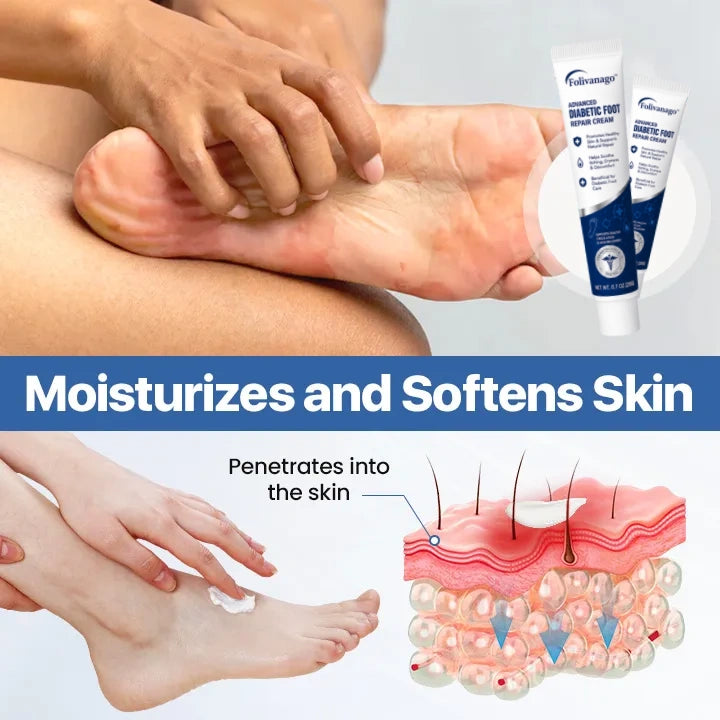 LIMITED TIME 50% OFF🔥AnnieCare® VitaGluco Diabetes Treatment Cream -👨‍⚕️ American Academy of Dermatology (AAD) Approved
