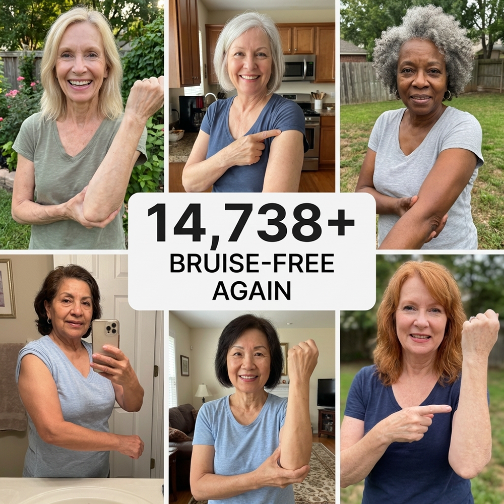 💥Over 100,000 units sold - Bruise Cream to repair bruises and strengthen the skin