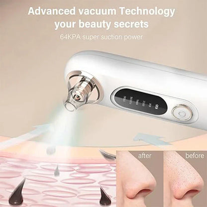 Pore Cleaner
